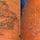 Vanish Laser Tattoo Removal and Skin Aesthetics - 26.09.14