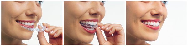Viechnicki Orthodontics Kutztown - 08.11.12