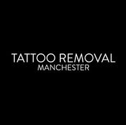 Tattoo Removal Manchester - 20.07.21