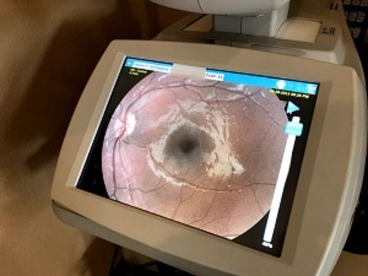 HindSight Eyecare 1 Hour Optical & Eye Exams The Villages, FL - 01.10.18